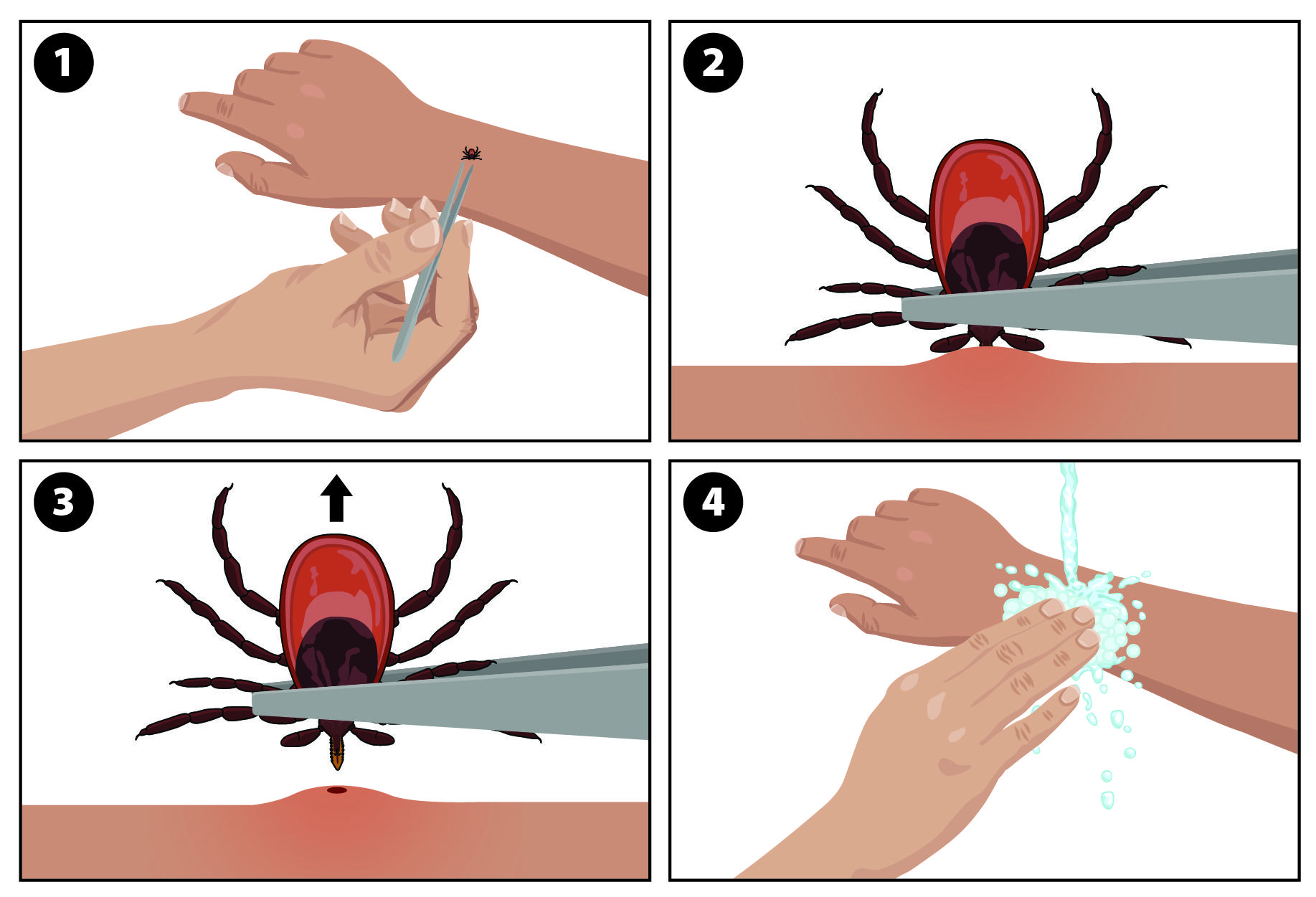 18_293708_tick_removal_rectangle_print (1)